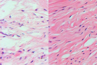 Regenerated sheep meniscus tissue